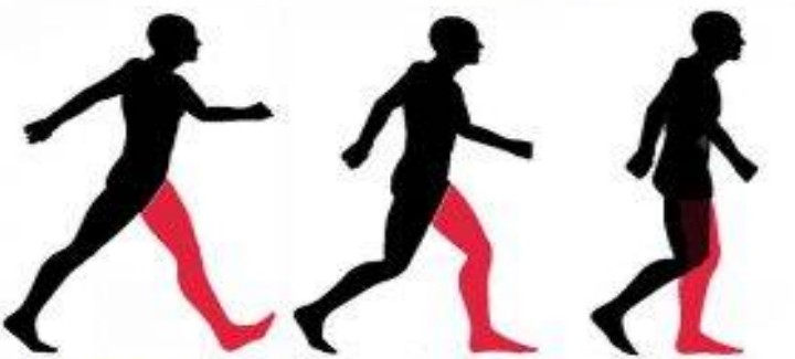آموزش مجدد راه رفتن (Gait Training)؛ بازگشت به استقلال حرکتی