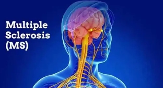 مناسب‌سازی خانه برای بیماران ام‌اس (MS): راهنمای جامع ایمنی و استقلال